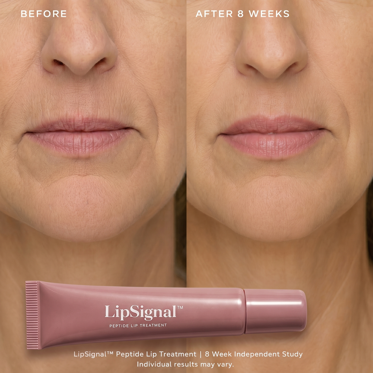 Peptide Lip Treatment